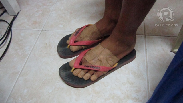 TAPE IS ALL. Angelica De Josef's feet wrapped in tape after a day of running competitions. Isabel Rodriguez.