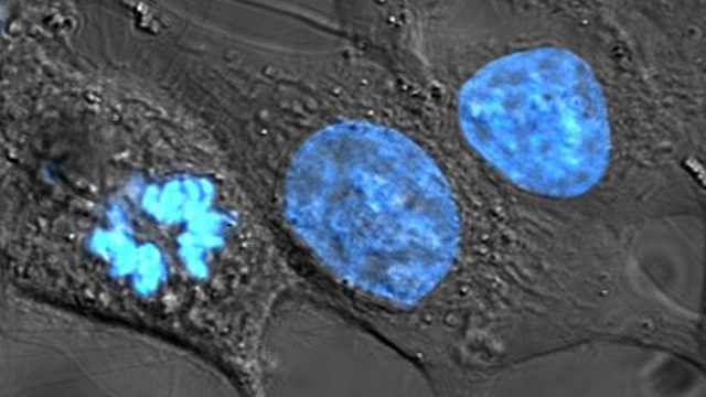 HeLa cells stained with Hoechst 33258. Public domain/Wikipedia