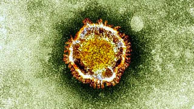 wrap-WHO-cites-deaths-MERS-virus-cases-Saudi-08292013-ver1.jpg